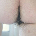 Hairy is best