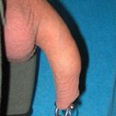 Long Foreskin waiting of Large Labia