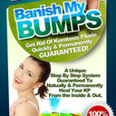 Banish My Bumps Review